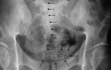radiographie de controle